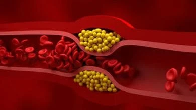 Troppi grassi nel sangue: nuovi dati per una terapia orale più efficace nel ridurre il colesterolo