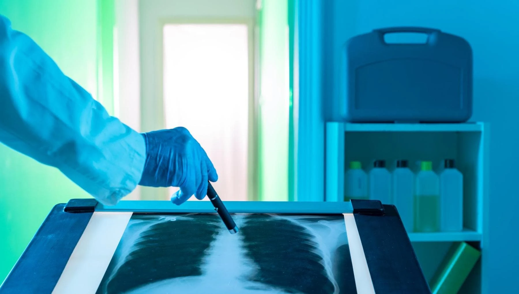 Tumore al polmone, il robot ‘fotografa’ anche noduli piccolissimi e rivoluziona la diagnosi precoce