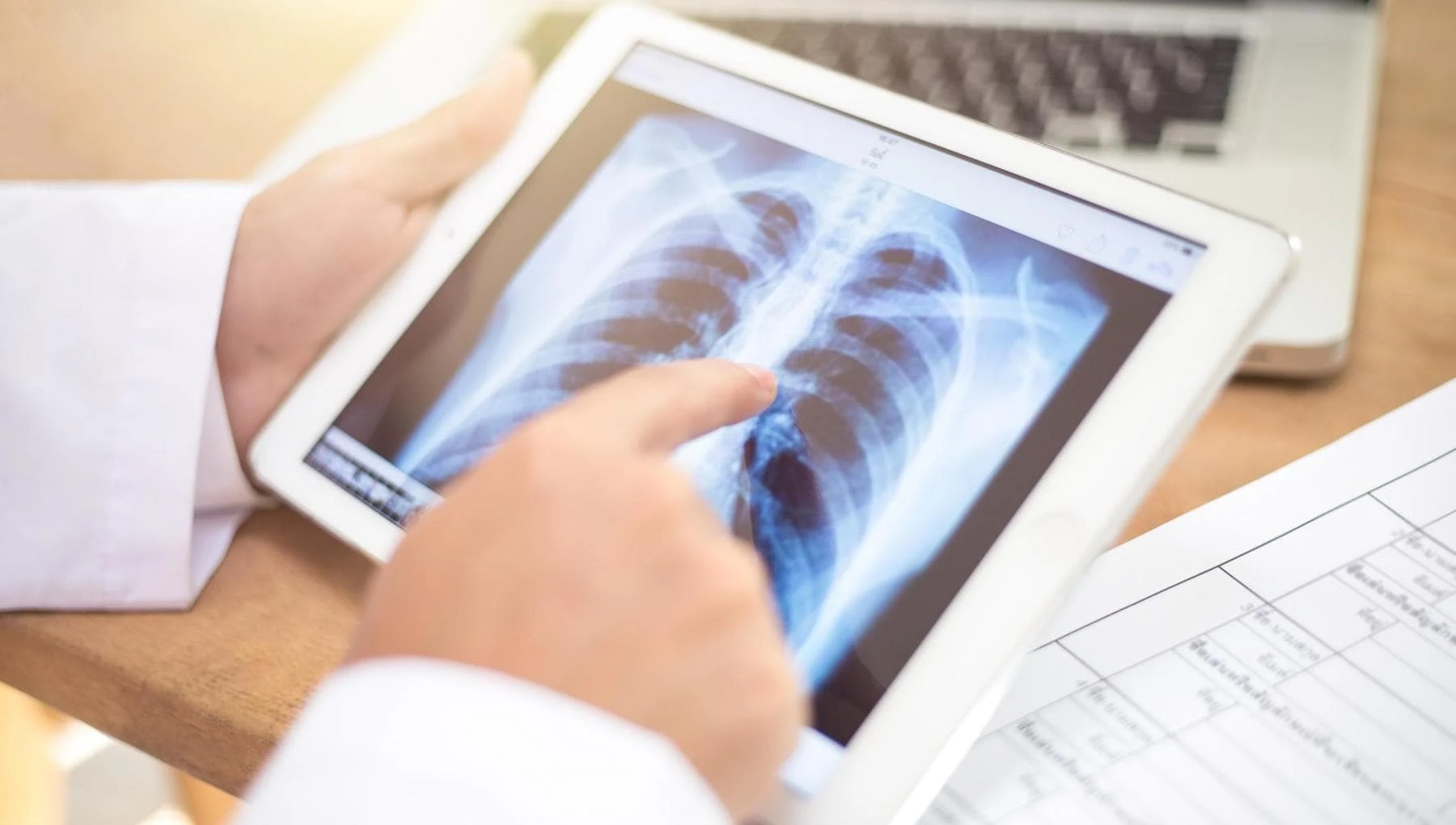 Tumore del polmone a piccole cellule, una nuova combinazione migliora la sopravvivenza