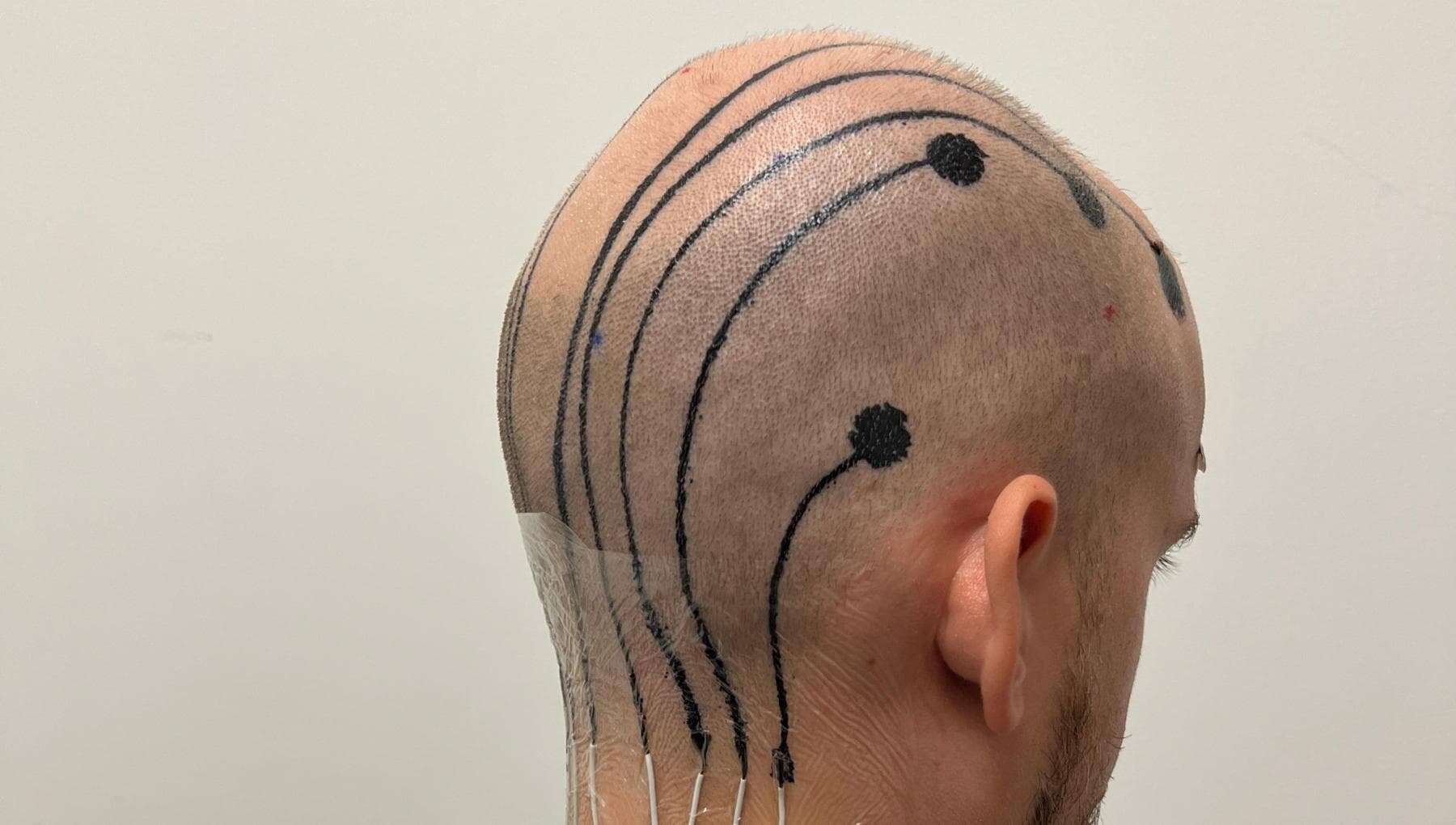 Un tatuaggio sulla testa per misurare le onde cerebrali