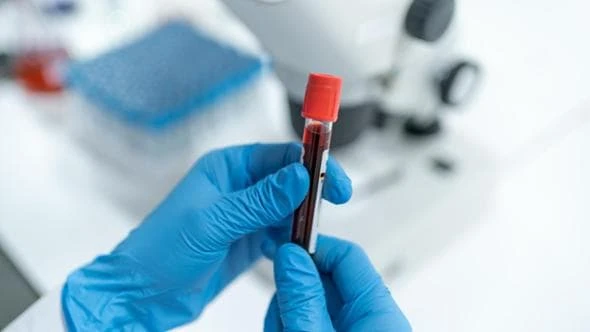 Tumori, l’appello degli oncologi per biopsia liquida e terapie mirate