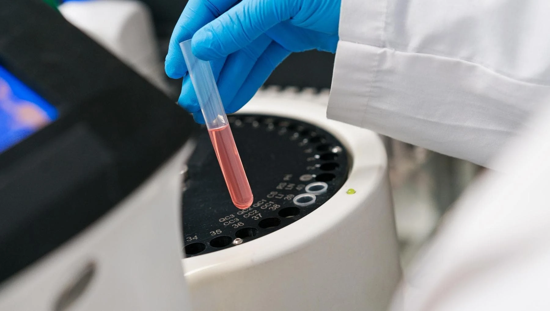 Mal di pancia e gonfiore addominale: un esame del sangue può aiutare la diagnosi di tumore