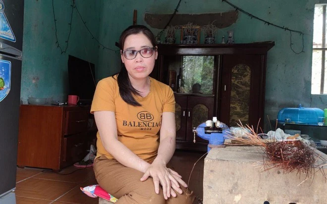 Người phụ nữ bị hãm hại bằng axít: 5 năm “vết thương cuồng yêu” chưa lành