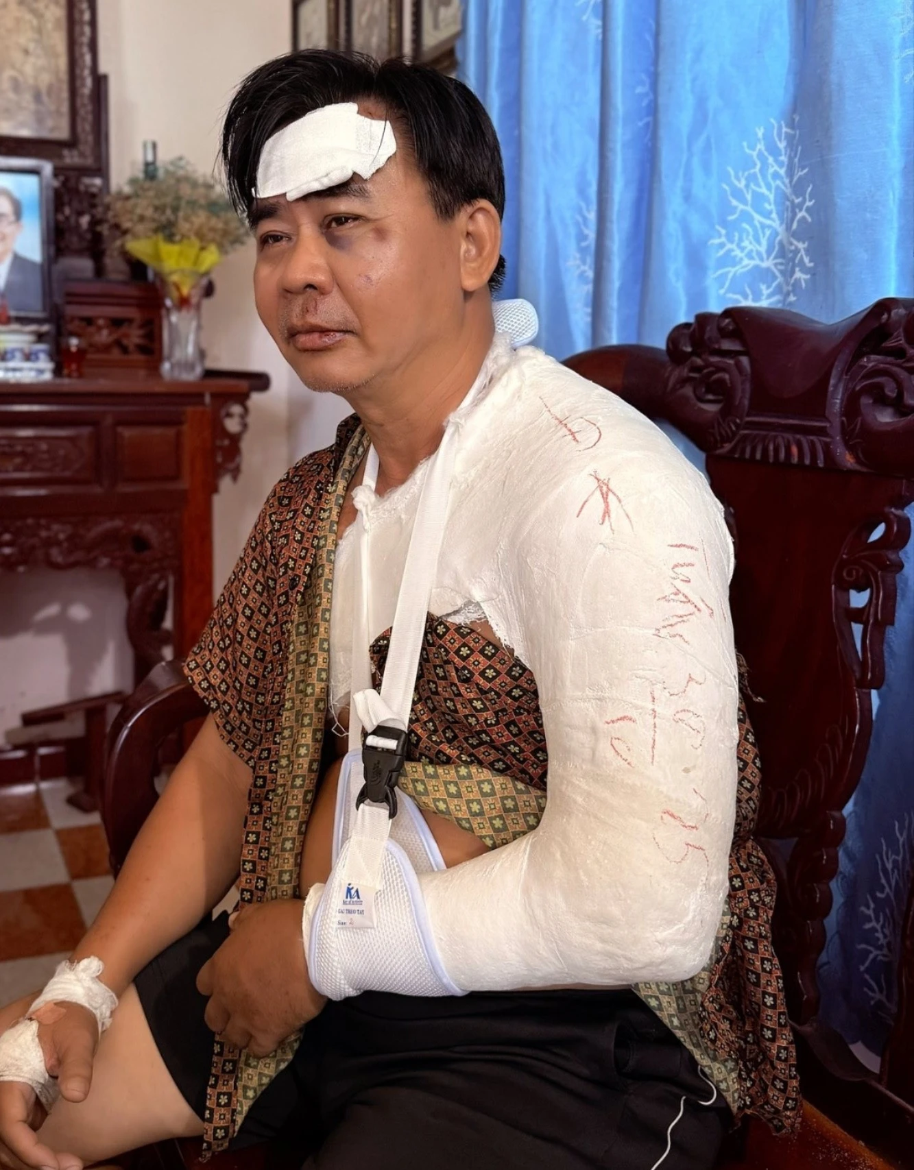 Tình trạng nghệ sĩ Chánh Thuận sau tai nạn xe