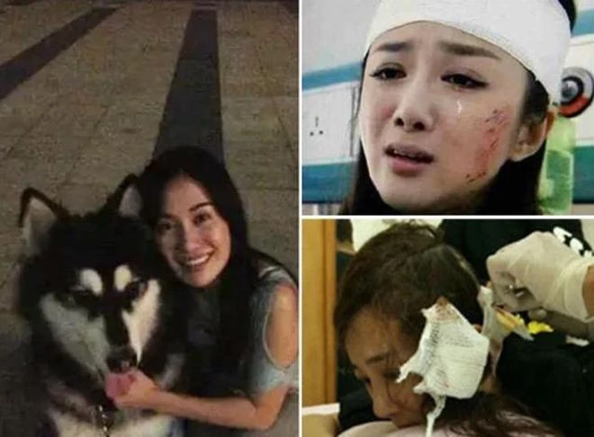 Cuộc sống hiện tại của nữ diễn viên từng là mỹ nhân cổ trang, bị chó cắn hủy dung