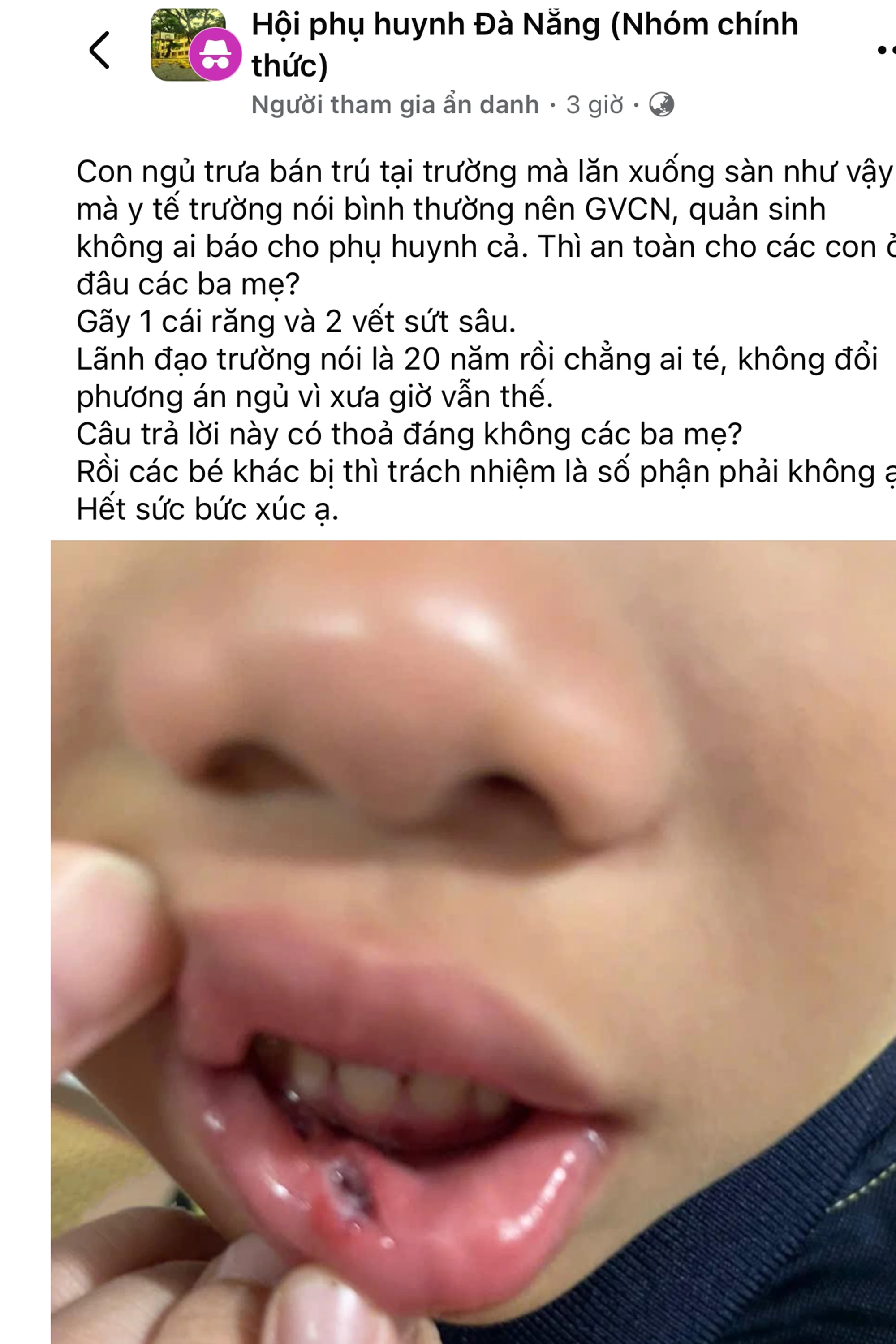 Đà Nẵng: Lãnh đạo trường tiểu học lên tiếng việc học sinh ngã xuống đất giờ ngủ trưa