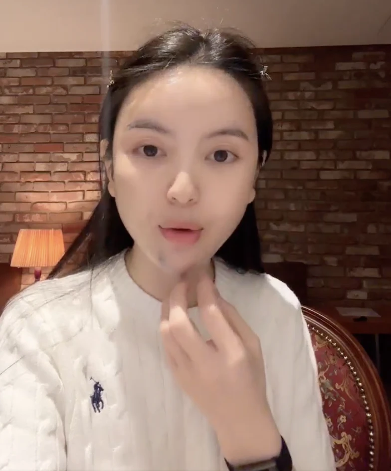 Chu Thanh Huyền kể lại trải nghiệm kinh hoàng khi đi xử lý hậu quả phẫu thuật thẩm mỹ