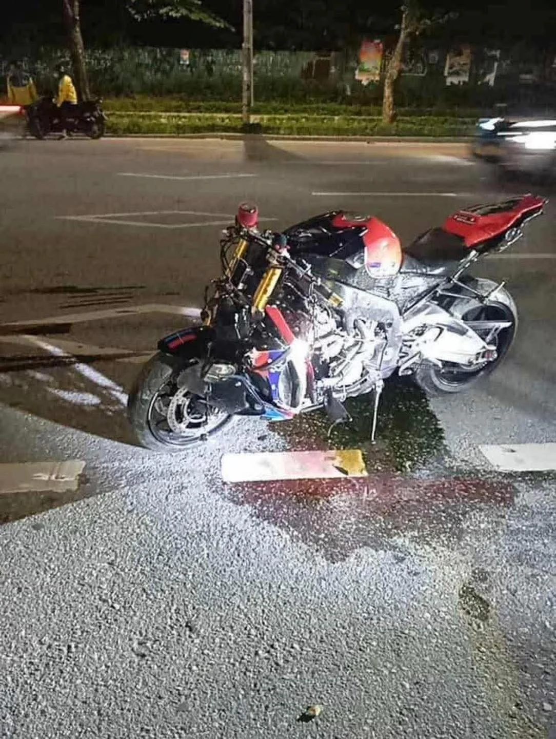 Kỳ tích 6 tiếng nối lại chân cho cô gái 19 tuổi sau tai nạn kinh hoàng với xe phân khối lớn ở Hà Nội