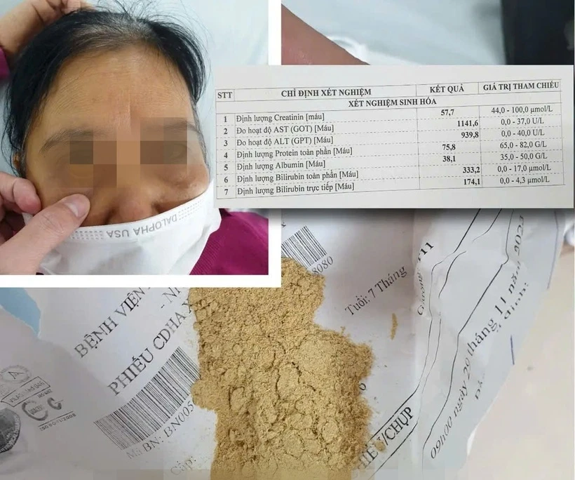 Cụ bà 70 tuổi suy thận cấp vì dùng thuốc mua qua mạng