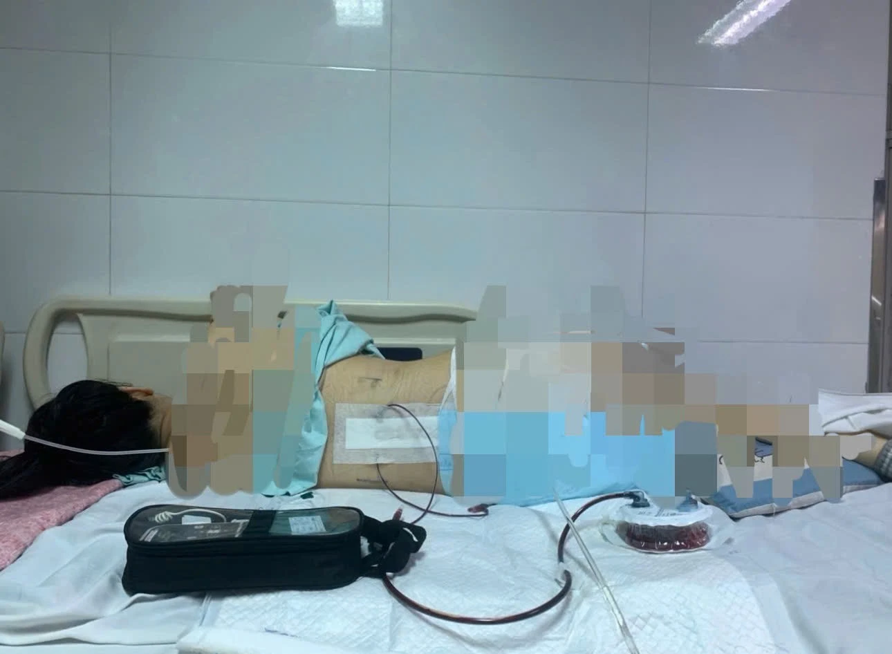 Khởi tố vụ cô gái mất 96% sức khỏe vì bị khung đỡ đèn tiệc cưới đổ sập, đè lên người