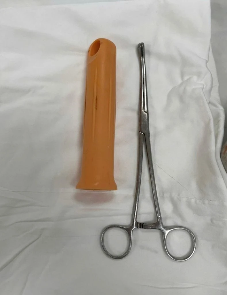 Cấp cứu nam thanh niên 23 tuổi ở TP.HCM bị kẹt cán cây lau nhà khoảng 15cm trong hậu môn