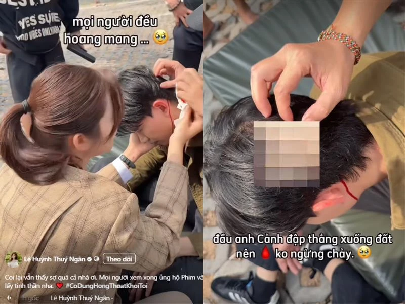 Thúy Ngân hốt hoảng khi Võ Cảnh chảy máu đầu