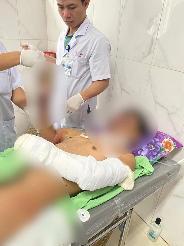 Bé trai 12 tuổi ở Đắk Lắk dập nát 2 bàn tay do pháo nổ