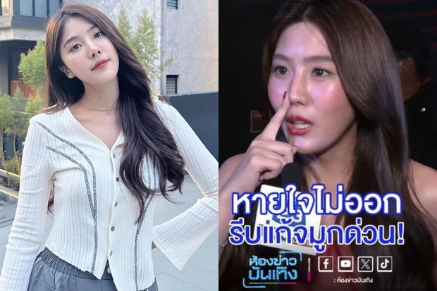 Nữ ca sĩ khó thở, mất 343 triệu đi sửa lại mũi và ngừng hoạt động đến nửa năm chỉ vì “dao kéo” hỏng