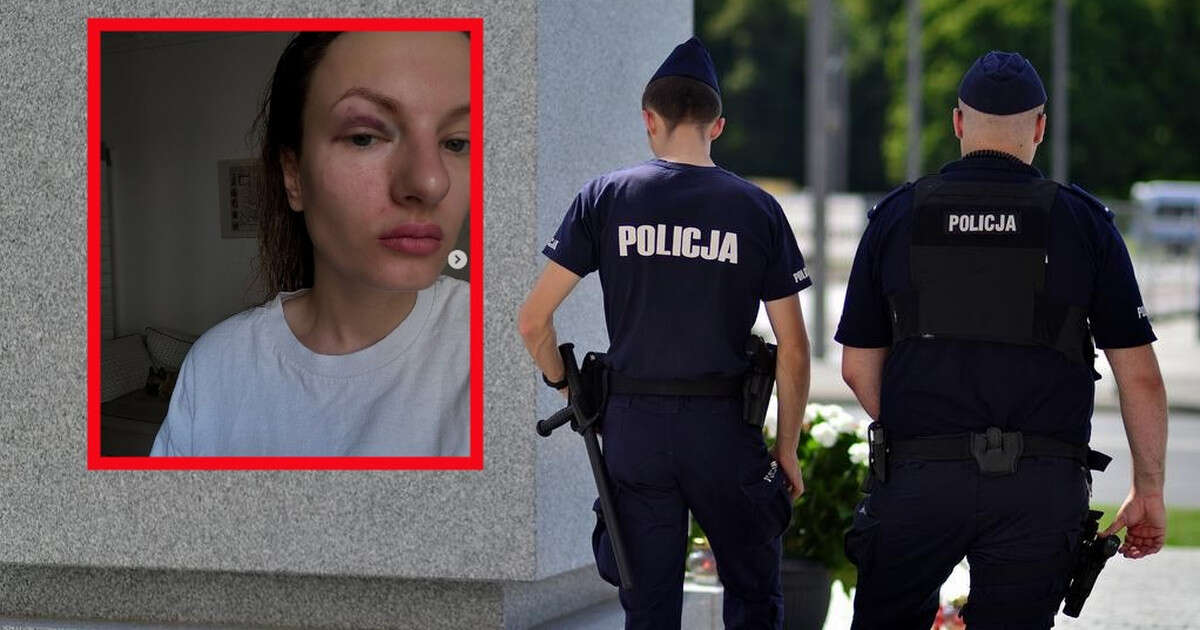 Napastnik pobił kobietę w samym centrum Warszawy. Policja puściła go wolno