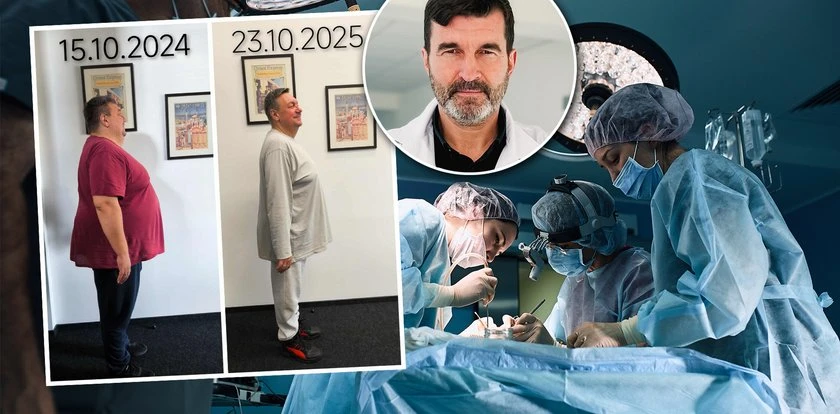 Zmniejsza żołądki setek pacjentów rocznie. 