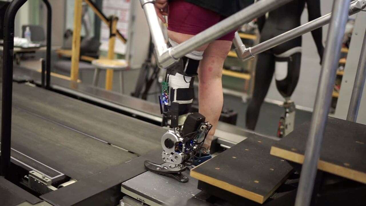 New prosthetics restore natural movement via nerve connection