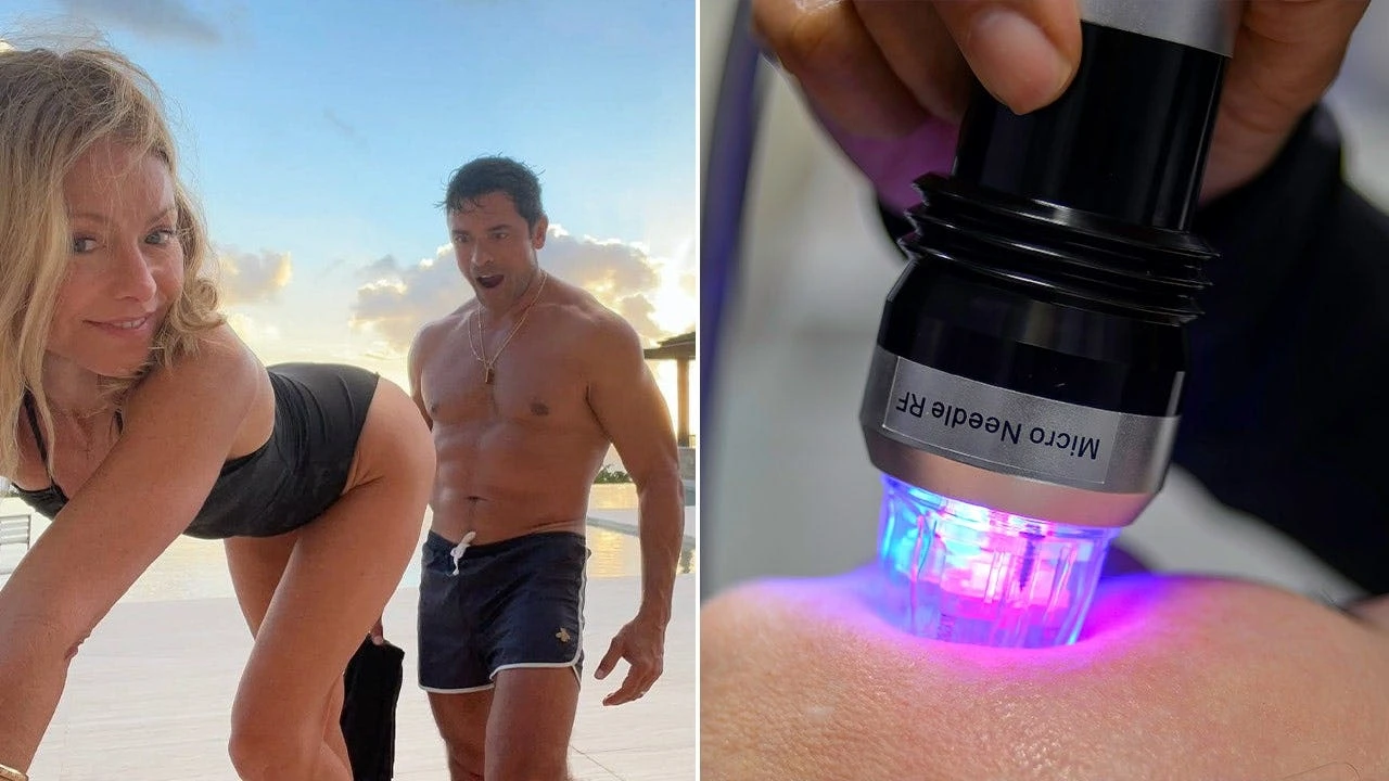 What is butt microneedling? Behind the 'desperate' procedure Kelly Ripa tried