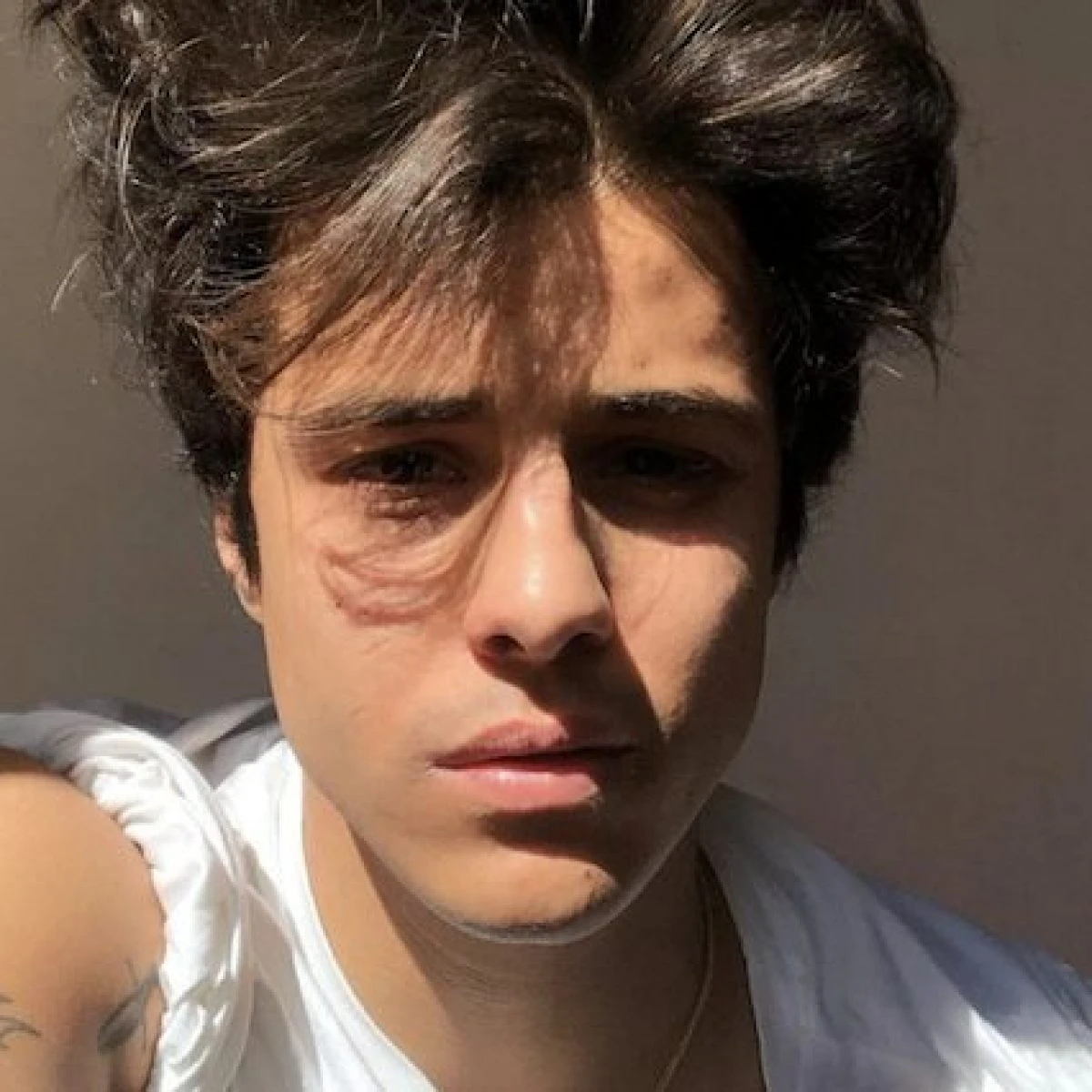 Michele Merlo, in ferie forzate il medico che lo accusò di fare uso di droghe