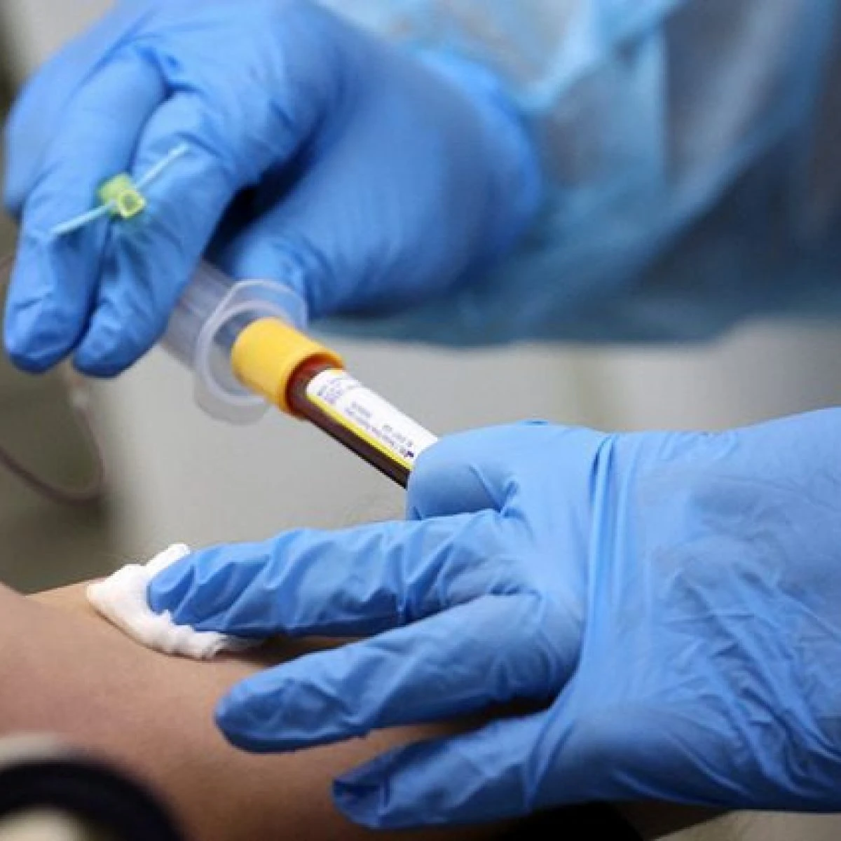 Rivoluzionario esame del sangue indica in “tempo reale” se la terapia anti cancro funziona