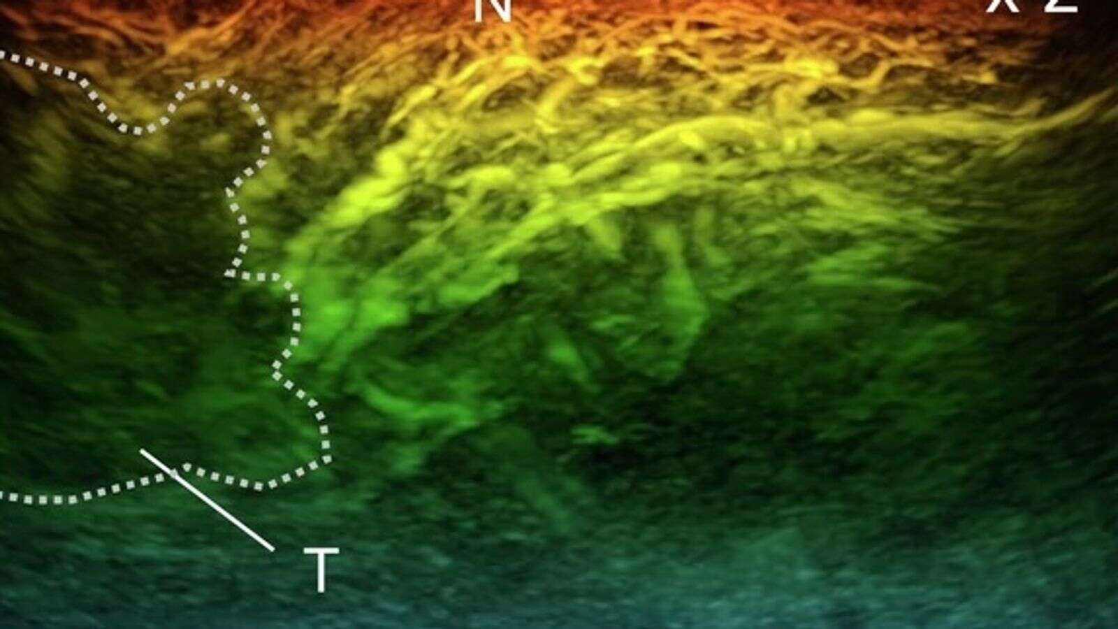 New miniature scanner could revolutionise diagnosis of diseases like cancer and diabetes