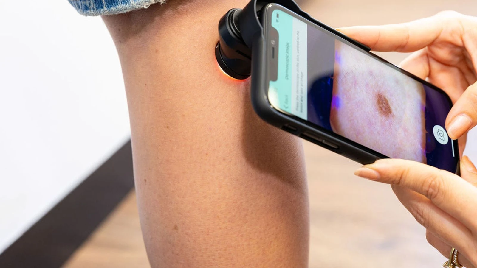 Skin cancer detection firm lands £15m to fund growth plans