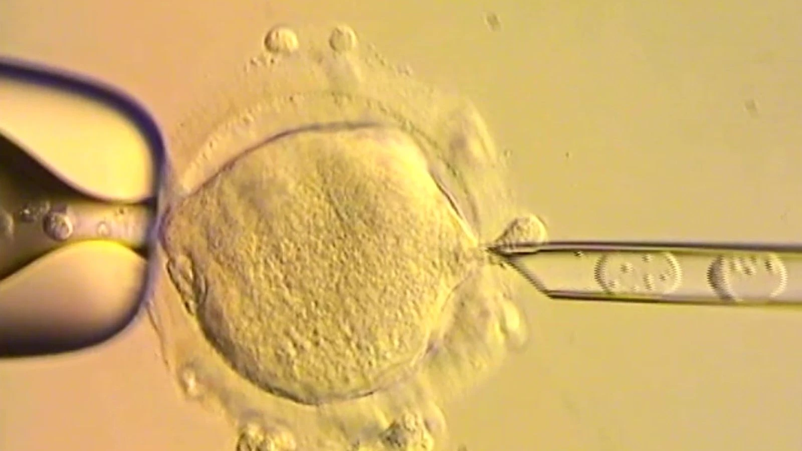 Babies born in UK with DNA from three people to treat inherited disease takes medicine into uncharted territory