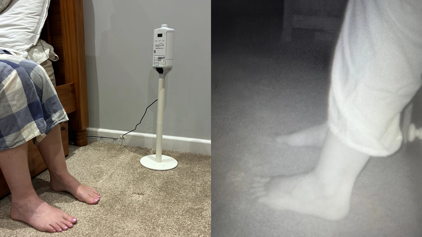 AI foot scanner recognises warning signs of heart failure to keep people out of hospital, researchers say