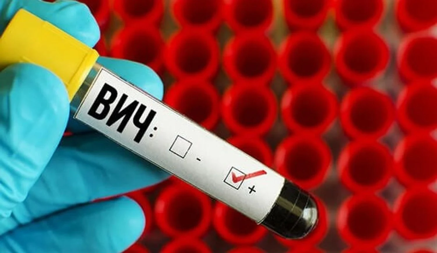 ВІЛ-інфекція поширюється в російських регіонах з катастрофічною швидкістю - розвідка