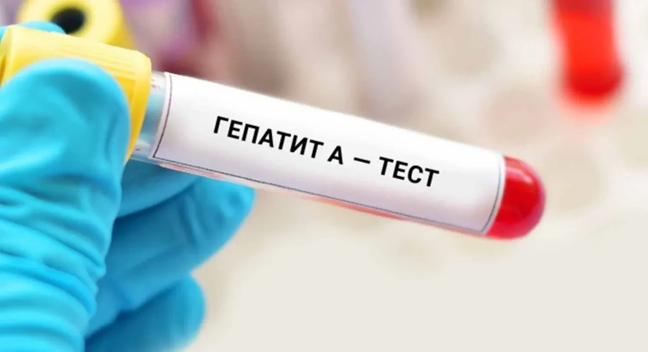 У Києві зафіксовано спалах гепатиту А - медики закликають до посиленої гігієни та вакцинації