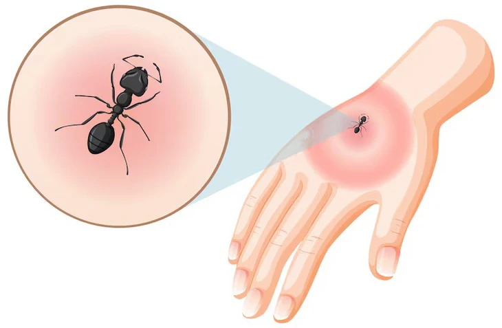 Thực hư chuyện dùng kiến để xua đuổi muỗi truyền bệnh chikungunya