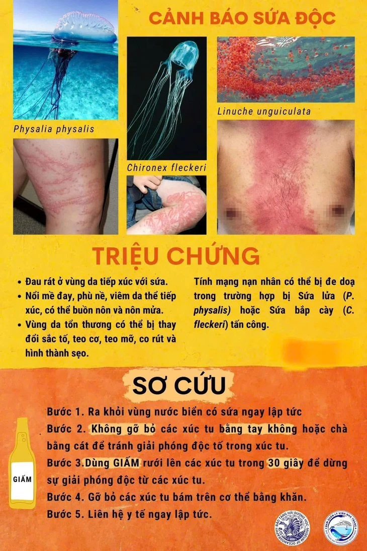 Mùa tắm biển, cẩn trọng với sứa lửa