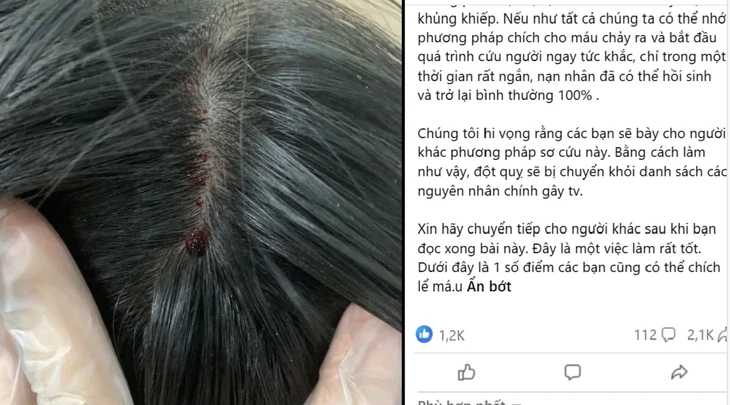 Chích máu đỉnh đầu, dái tai để chữa đột quỵ?
