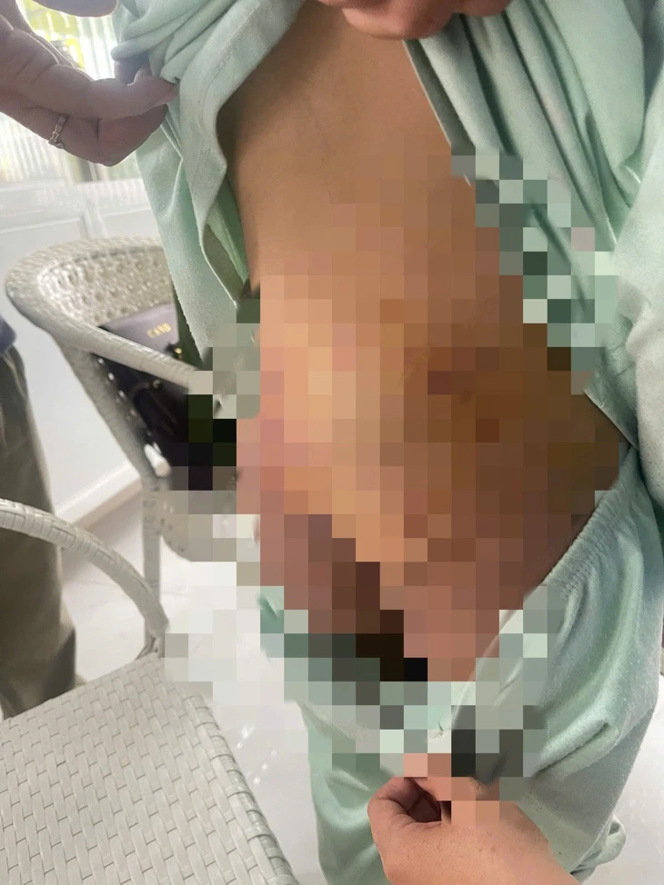 Khởi tố người phụ nữ và bạn trai bạo hành bé gái 9 tuổi ở TP.HCM