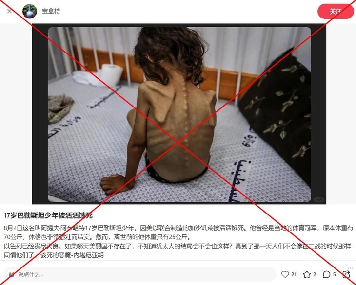 Bức ảnh bé gái 7 tuổi ở Dải Gaza bị nhầm là thiếu niên 17 tuổi chết vì đói