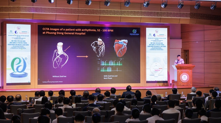 Ung thư và đột quỵ gia tăng: Có nên chụp CT để tầm soát?