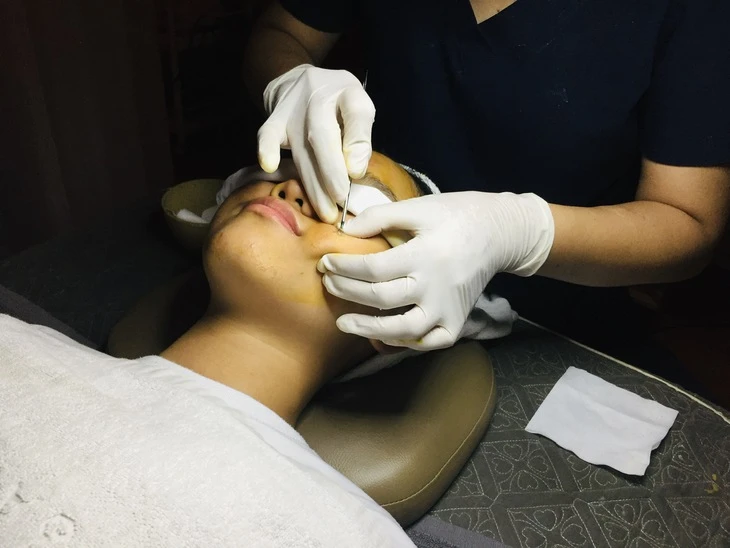 Căng thẳng tâm lý có phải là 'thủ phạm thầm lặng' khiến làn da xuống cấp?