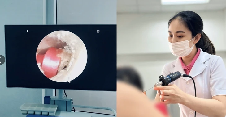 Bé gái 6 tuổi suýt thủng màng nhĩ vì một sợi dây buộc tóc