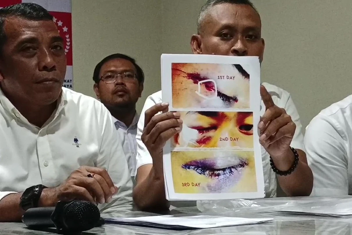 Kasus Kekerasan Siswa SMA di Malang Mandek, Orang Tua Desak Keadilan