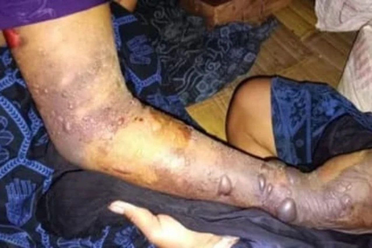 Tujuh Warga Badui Meninggal Dunia Akibat Gigitan Ular Berbisa