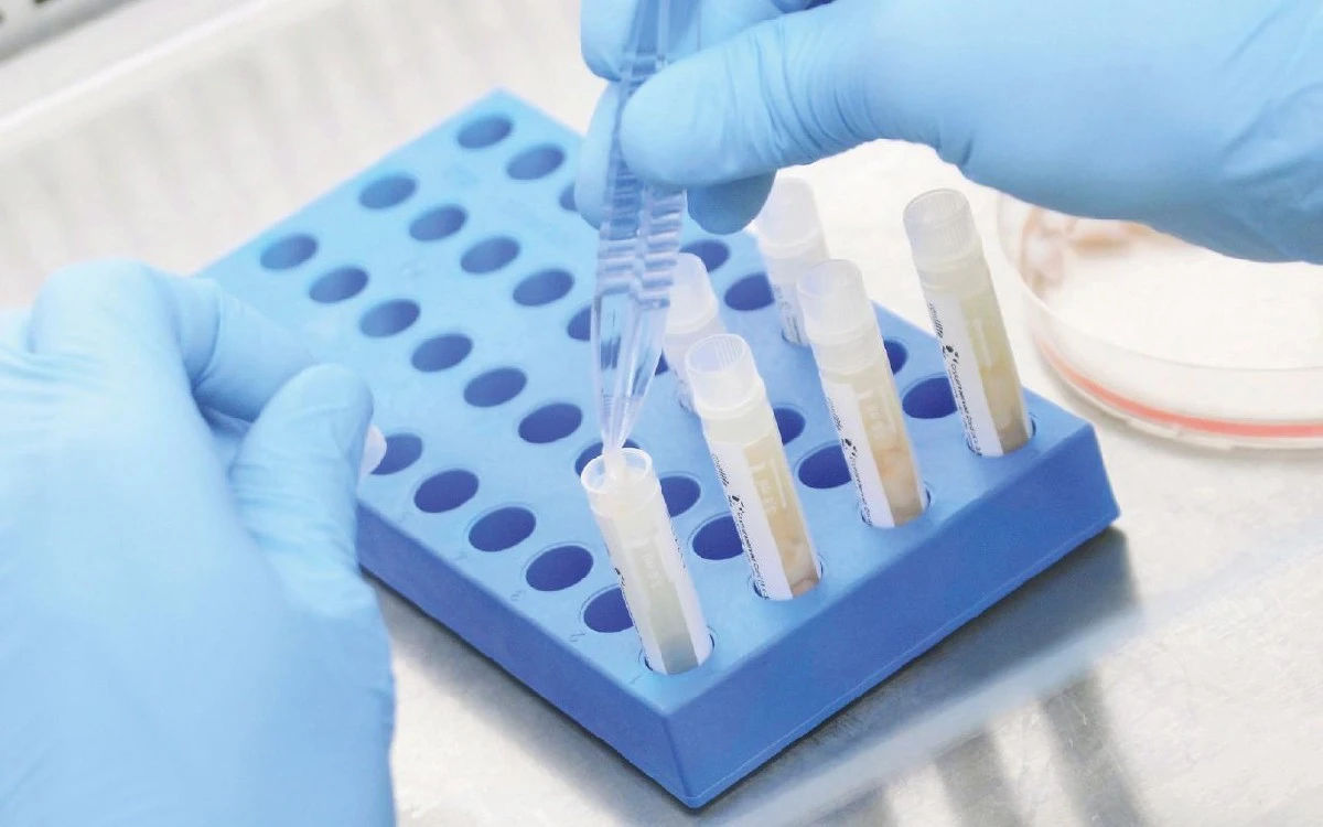 Stem Cell Bisa jadi Alternatif Penyembuhan Cedera Organ Tubuh