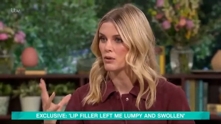 Ashley James issues botox warning after jab left her unable to smile
