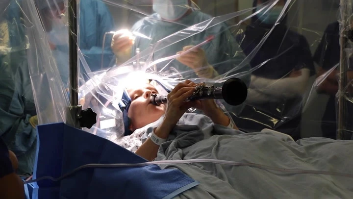 Woman plays clarinet during four-hour brain surgery for Parkinson’s
