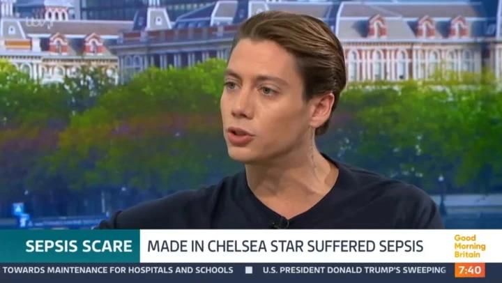 MIC star shares critical missed sepsis signs after near-death ordeal