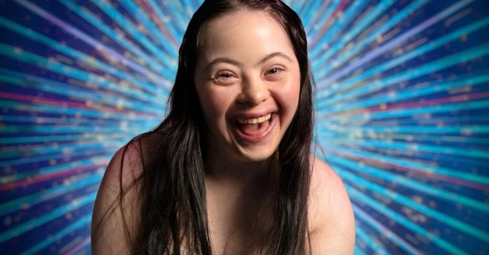 Modelo com síndrome de Down vai disputar versão britânica do Dança dos Famosos 2025