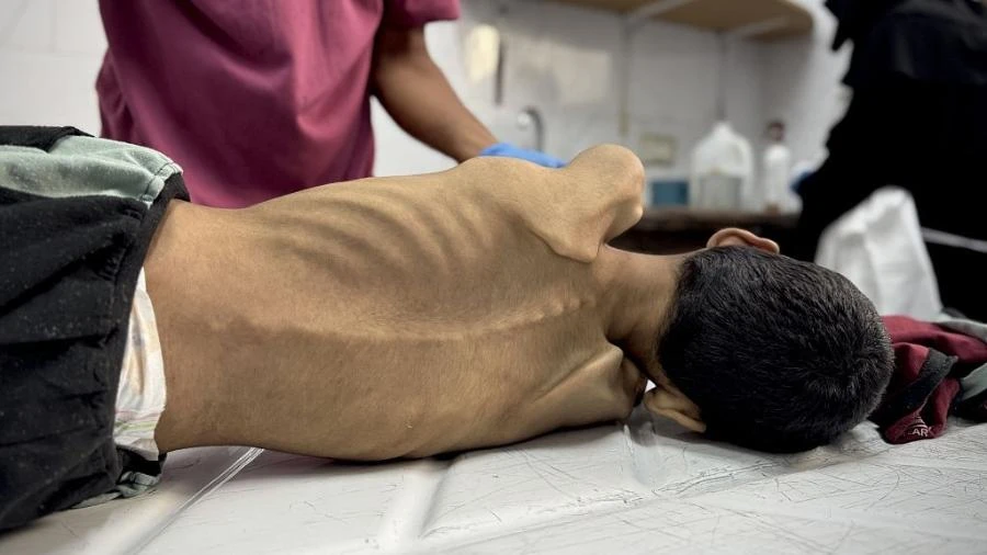 Sete novos palestinos morrem de fome em Gaza; mortes chegam a 154