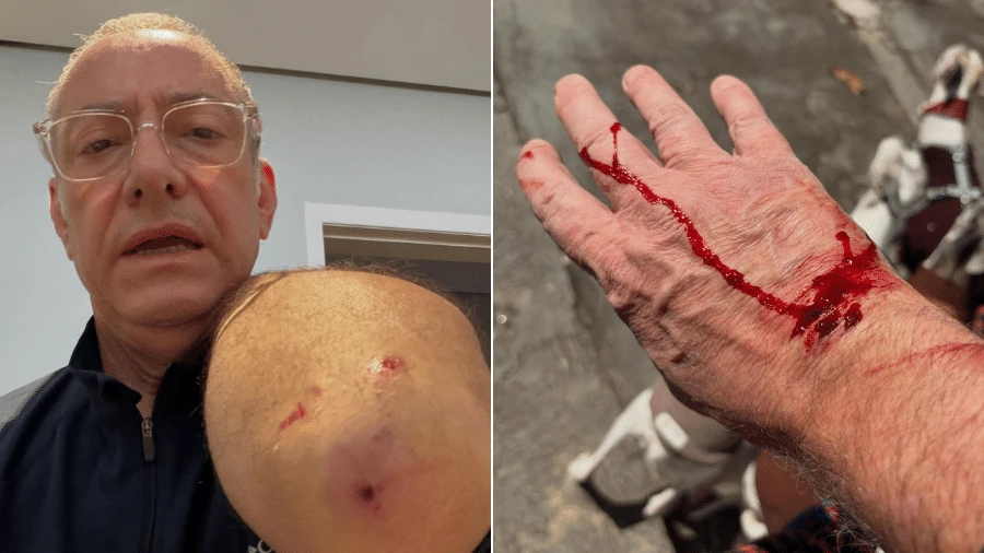 Jornalista da Globo é atacado por pitbull sem guia: tutor pode ser preso?