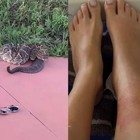 Gravou cobra 'sem querer' antes do ataque: cascavel pica mulher em Goiás