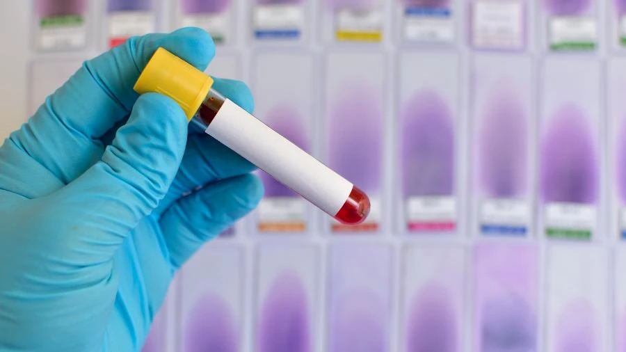 Biomédico suspeito de falsificar exames médicos em MT é preso