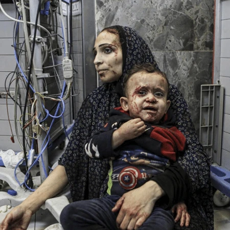 Reino Unido anuncia plano para tratar crianças de Gaza; 100 estão na lista